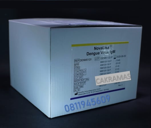 Novalisa Virus Dengue IgM