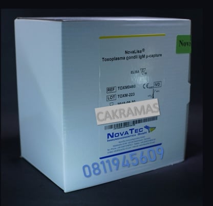 Toxoplasma Gondii IgM Capture